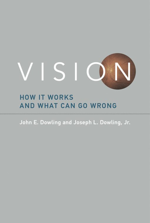 Vision: How It Works and What Can Go Wrong