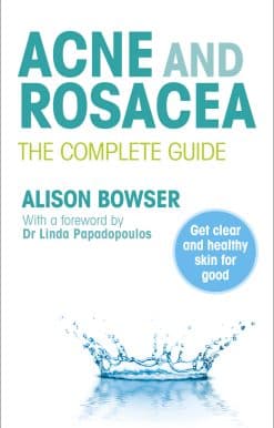 Acne and Rosacea: The Complete Guide